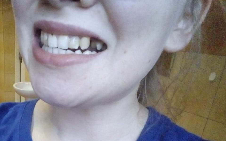 
        Zbiórka Chcę mieć piękny uśmiech! - zdjęcie główne
    