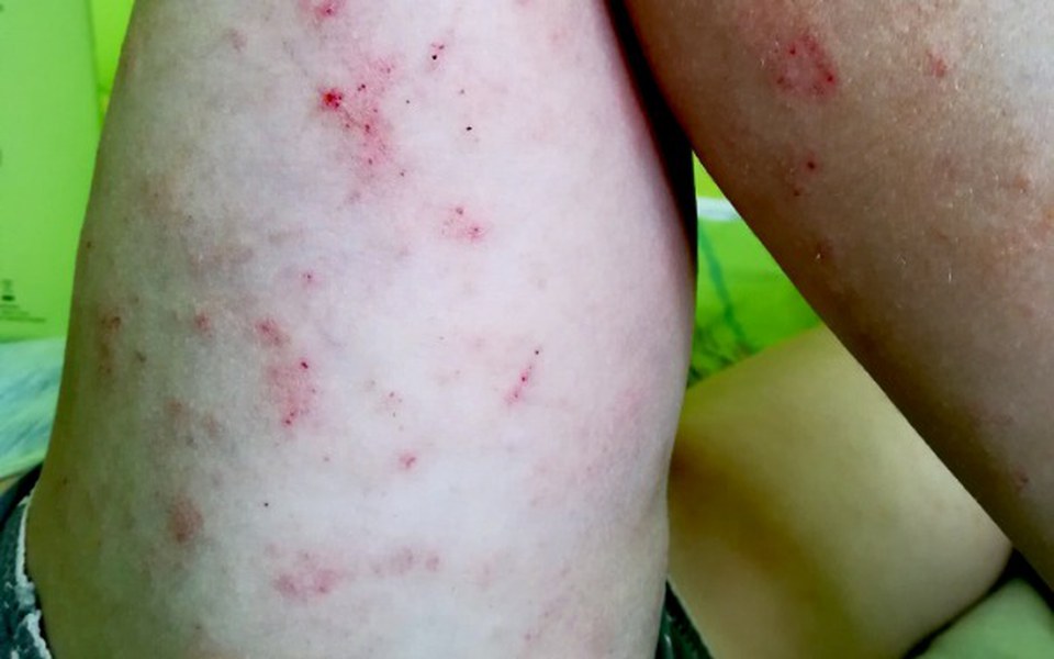 
        Zbiórka Walka z  AZS - zdjęcie główne
    