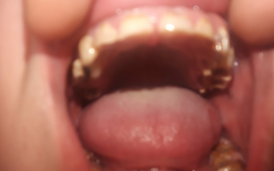 
        Zbiórka Każdy zasługuje na szansę - zdjęcie główne
    