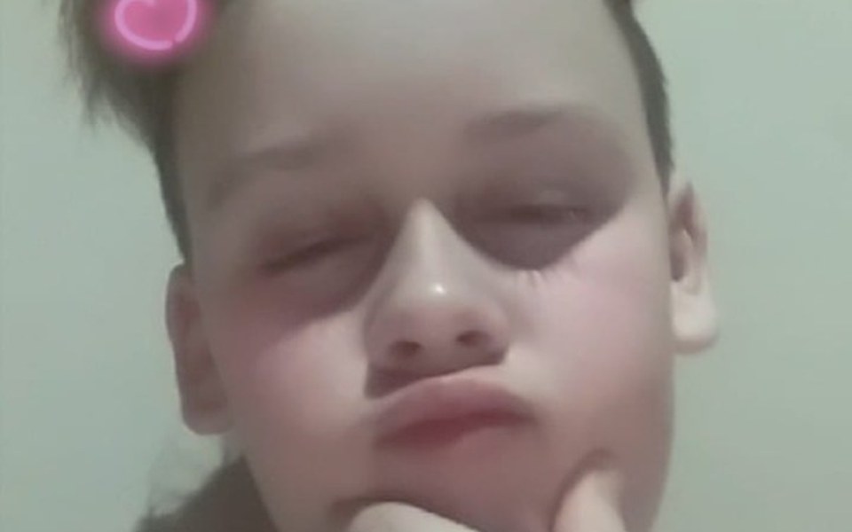 
        Zbiórka Na operację dla Gryzla - zdjęcie główne
    