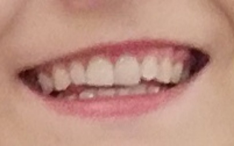 
        Zbiórka nowy aparat ortodontycznyy - zdjęcie główne
    