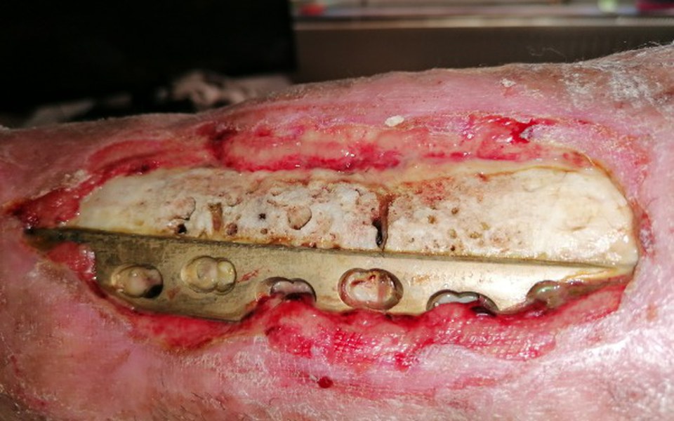 
        Zbiórka Operacja po wypadku - zdjęcie główne
    