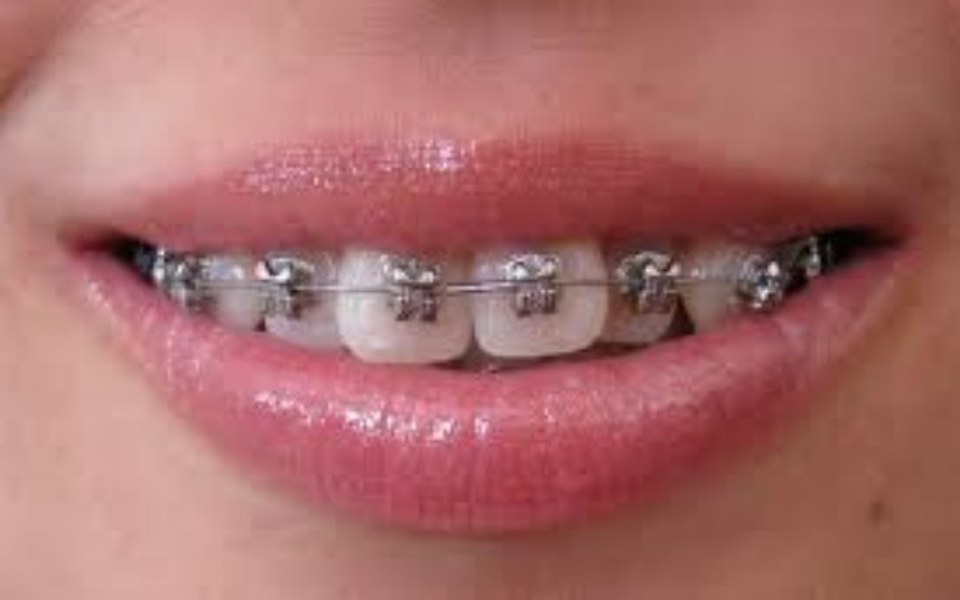 
        Zbiórka Aparat ortodontyczny 2019 - zdjęcie główne
    