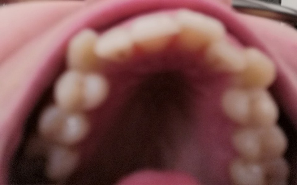 
        Zbiórka Podaruj mi nowy uśmiech ☺ - zdjęcie główne
    