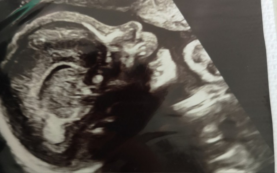 
        Zbiórka Mieszkanie dla przyszłej mamy. - zdjęcie główne
    