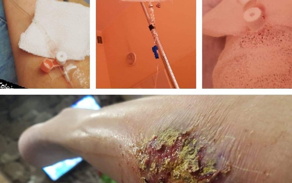 
        Zbiórka Na leki aby móc walczyć zchorobą - zdjęcie główne
    