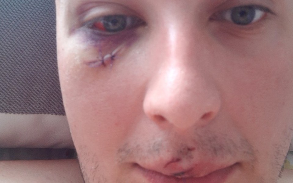 
        Zbiórka Zbieram na powrót do zdrowia po - zdjęcie główne
    