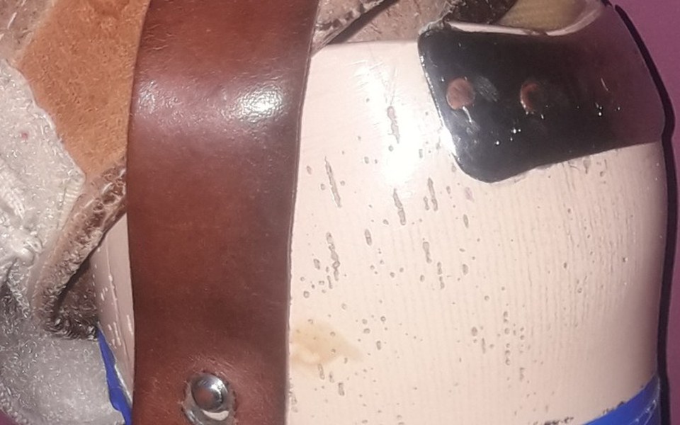 
        Zbiórka Proteza dla żony - zdjęcie główne
    