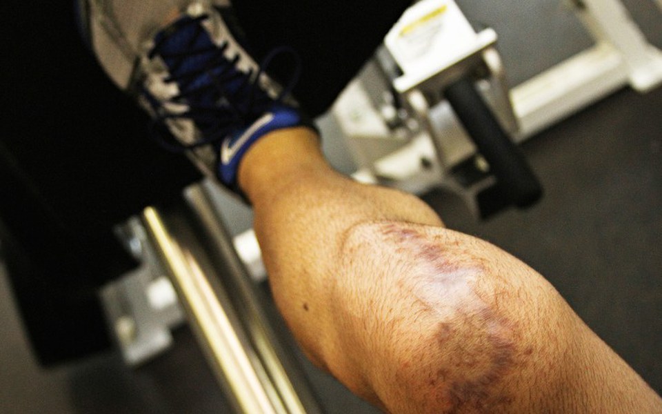 
        Zbiórka Zabieg kolana - zdjęcie główne
    