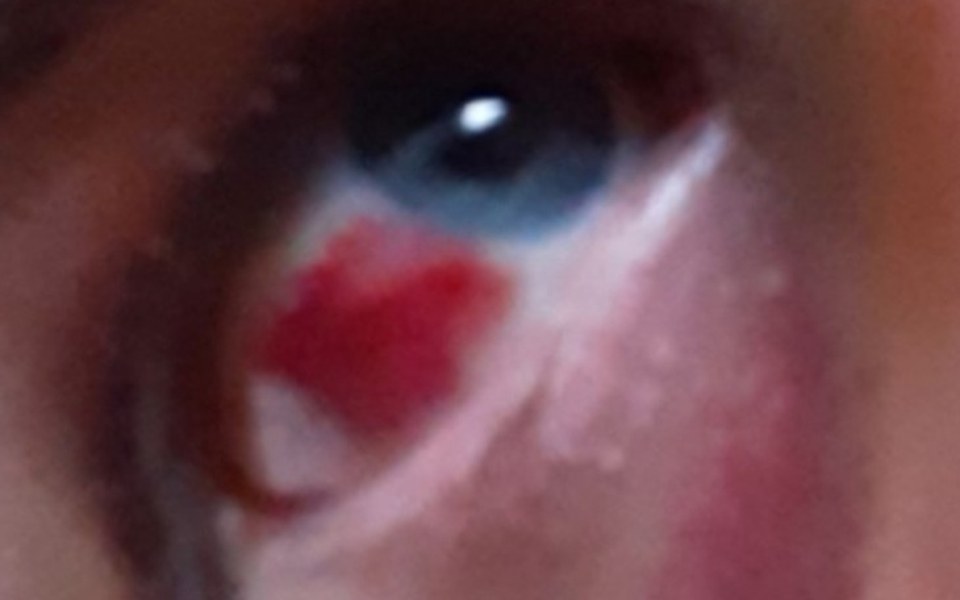 
        Zbiórka Rachunek za leczeni w Niemczech - zdjęcie główne
    