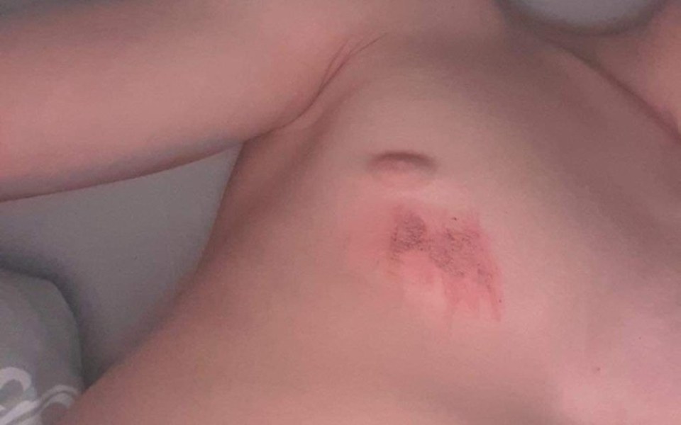 
        Zbiórka Pomoc na walkę z depresją - zdjęcie główne
    