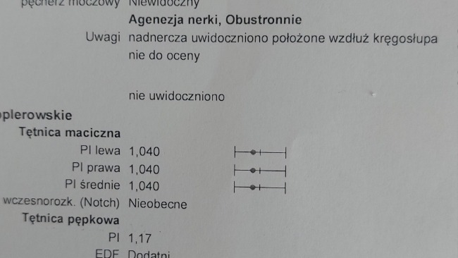 story_286082_1688797445.jpeg